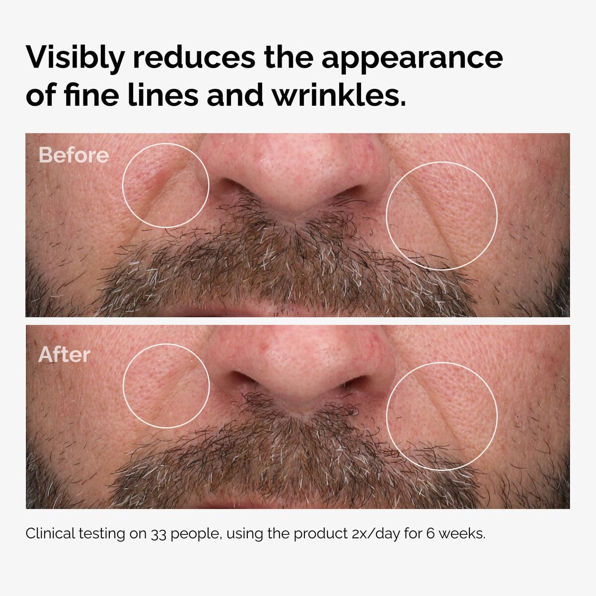 100-fermented-rose-hip-seed-oil-n5 100pct-fermented-rose-hip-before-after-wrinkles.jpg