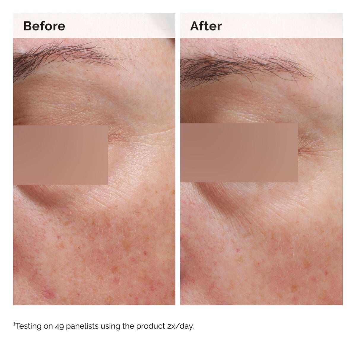 niacinamide-5-face-and-body-emulsion-u0 2024-08-23-ORD-Nia-5pct-Face-Body-B-A-Elasticity-Global-02-1x1.jpg