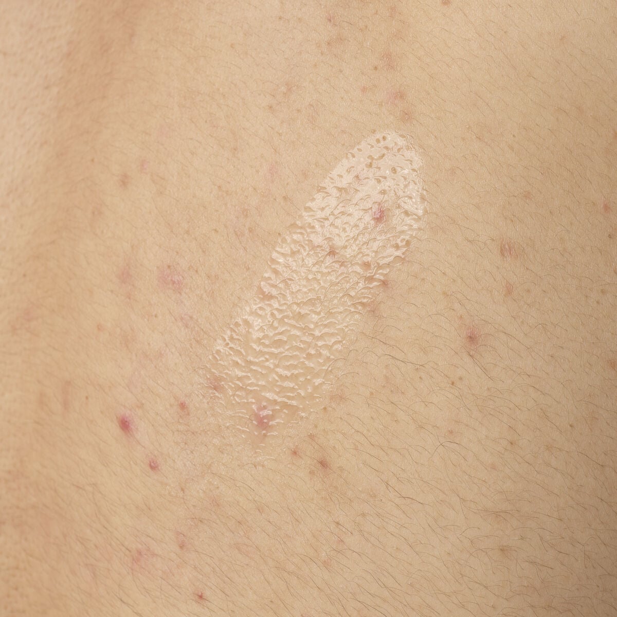 salicylic-acid-0-5-body-serum-k9 ORD-salicylic-acid-05-body-240ml-application.jpg