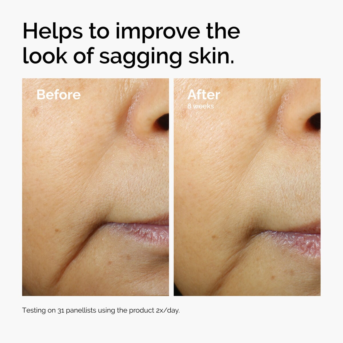 caffeine-3-escin-1-face-serum-s5 ord-caffeine-3pct-escin-1pct-face-serum-before-after-sagging.jpg