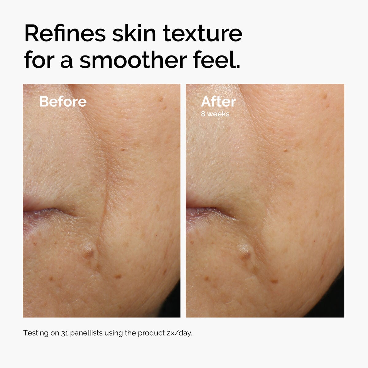 caffeine-3-escin-1-face-serum-s5 ord-caffeine-3pct-escin-1pct-face-serum-before-after-texture.jpg