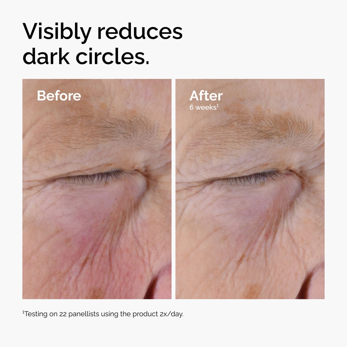 caffeine-solution-5-egcg-eye-serum-h6 ord-caffeine-solution-egcg-dark-circles-before-after.jpg