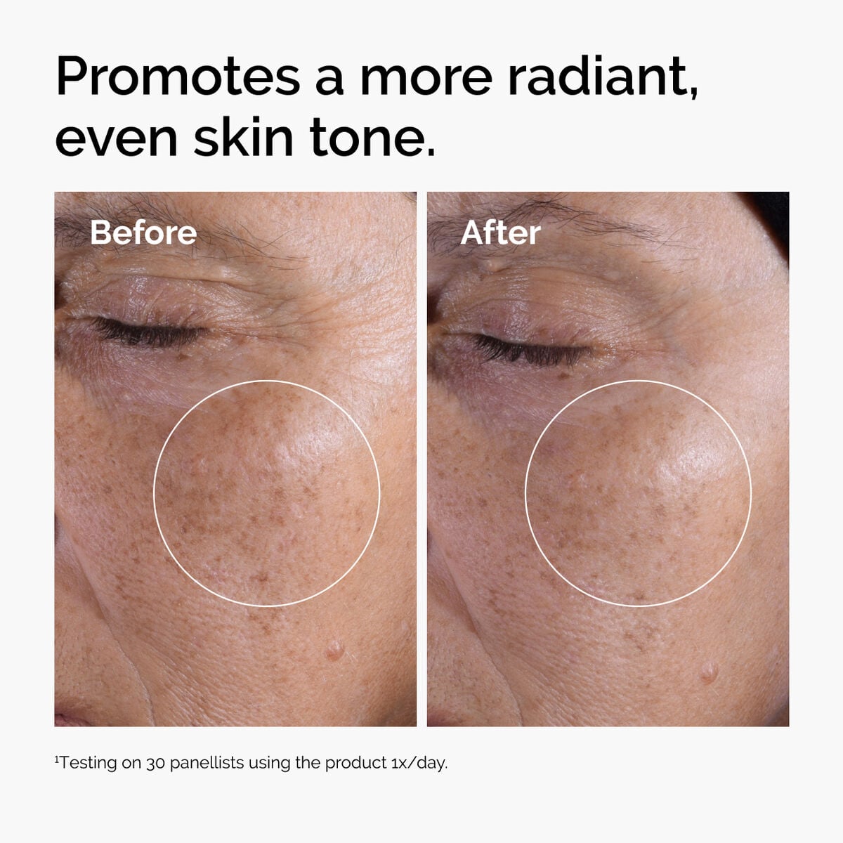 glycolic-acid-7-exfoliating-toner-x3 ord-glycolic-before-after-radiance.jpg