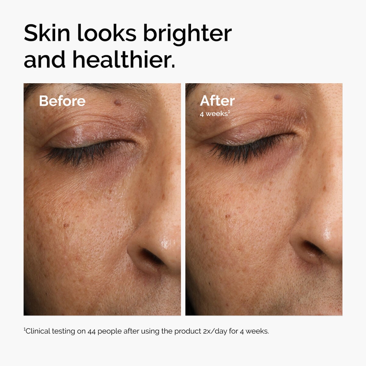 multi-antioxidant-radiance-serum-k1 ord-mars-before-after-healthy.jpg
