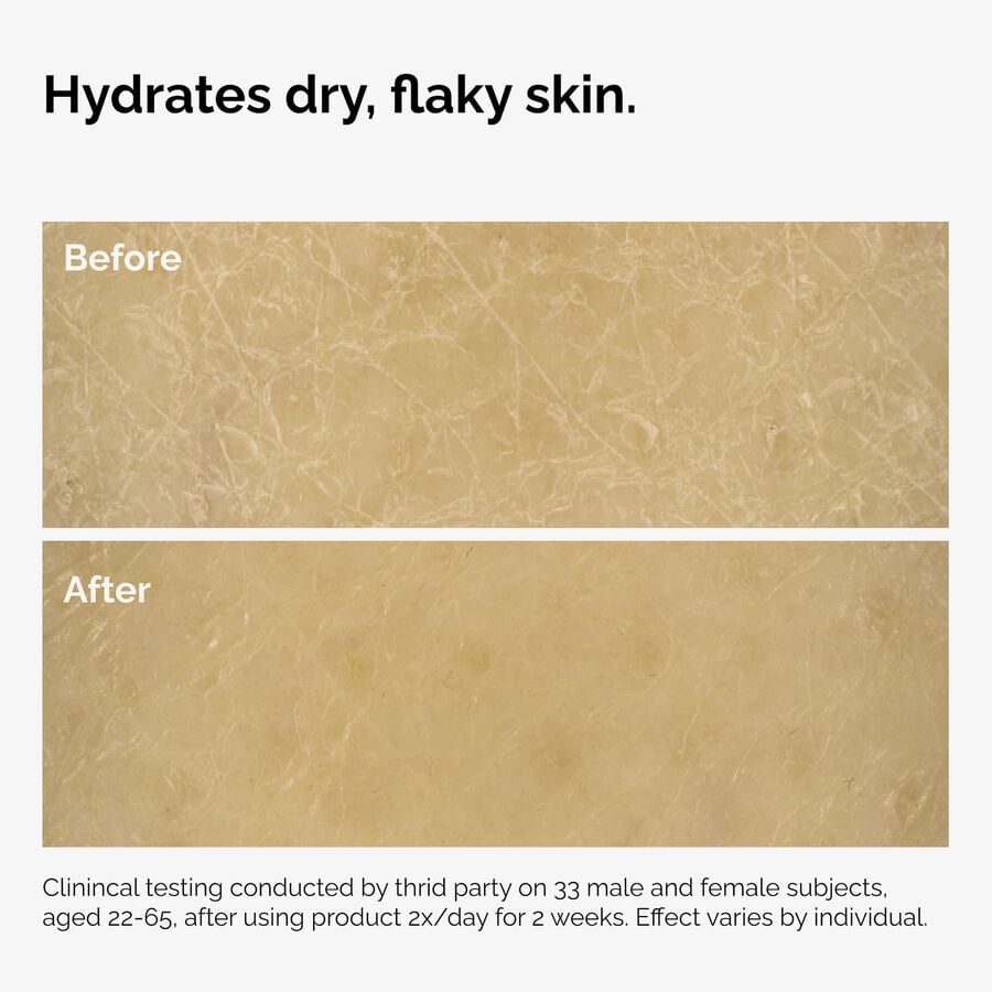 the-body-care-collection-n7 ord-natural-moisturizing-factors-inulin-body-before-after-graphic-02.jpg
