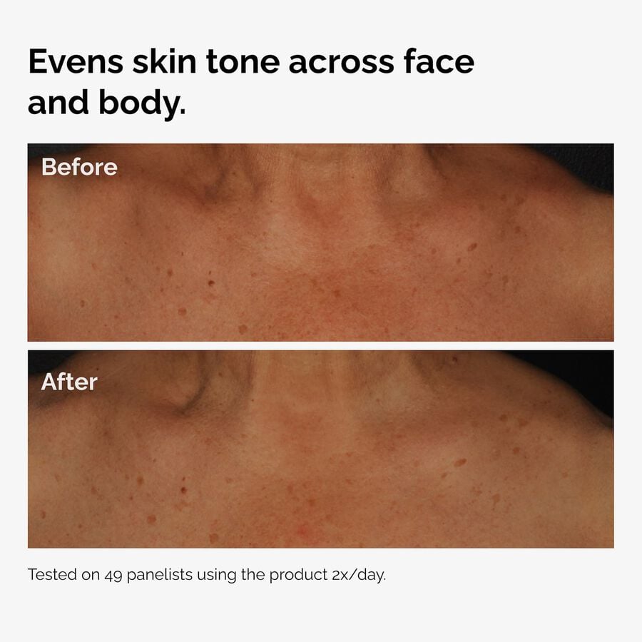 the-body-care-collection-n7 ord-niacinamide-face-body-serum-before-after-even-tone-graphic.jpg