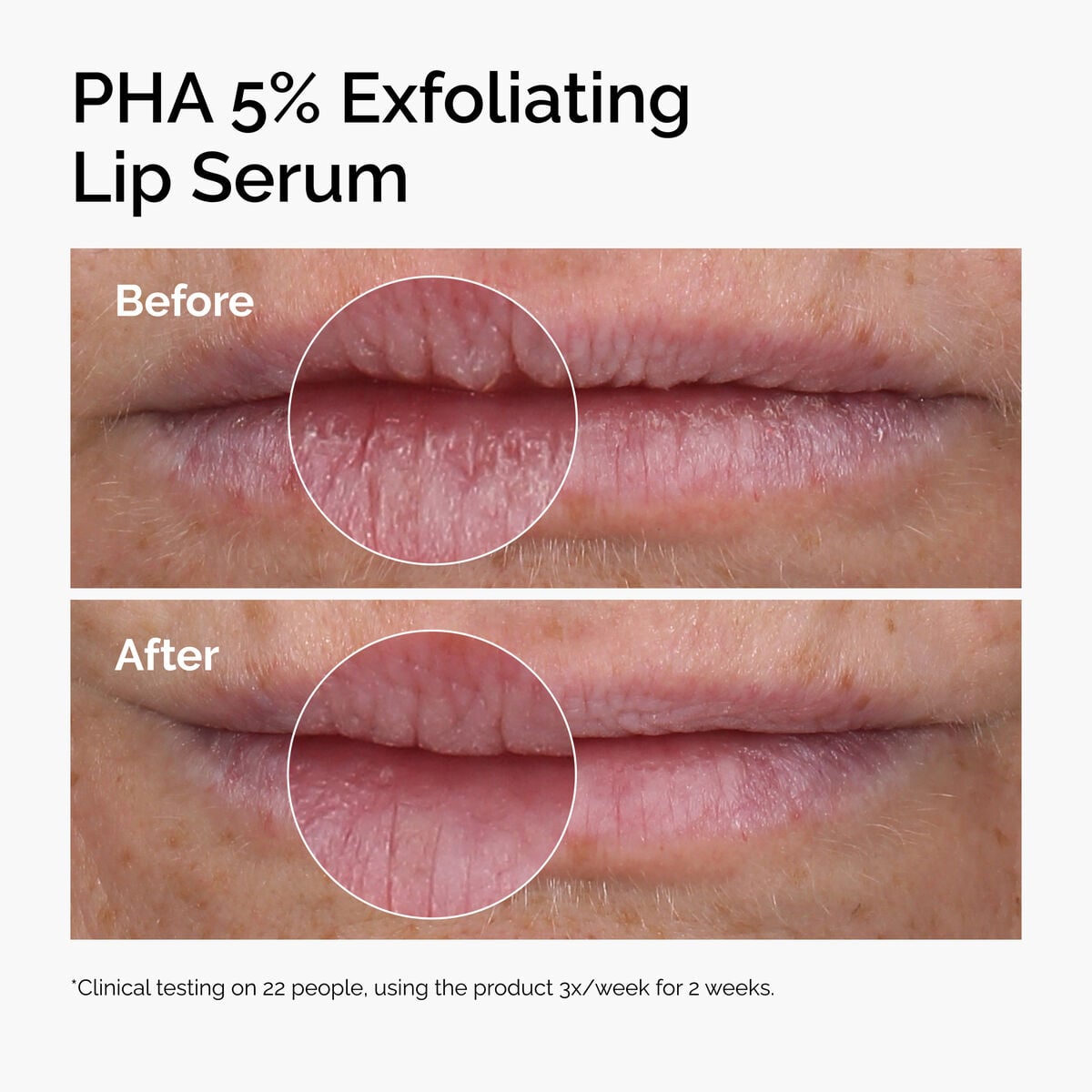 pha-5-exfoliating-lip-serum-v4 ord-pha-5pct-lip-exfoliating-serum-before-after.jpg