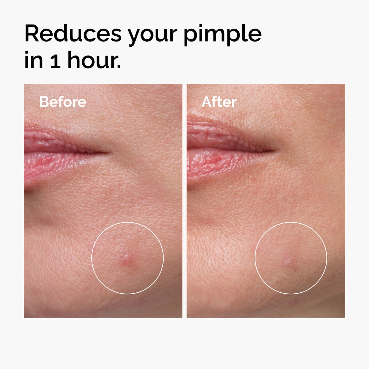 sulfur-10-powder-to-cream-concentrate-n0 ord-sulfur-10pct-powder-to-cream-concentrate-before-after-NA.jpg